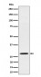 PSMB10 Antibody