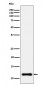 NDUFC2 Antibody