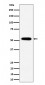 PPP2R5E Antibody