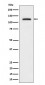 Phospho-ULK1 (S556) Antibody