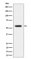 Phospho-Vimentin (S39) Antibody