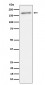 Phospho-ErbB2(Y1221 + Y1222)  Antibody 