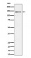 Ceruloplasmin Antibody