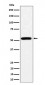 ALDH2 Antibody