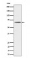 Phospho-P70 S6 Kinase beta (S371) Antibody