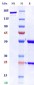 Anti-Monkeypox virus/MPXV M1R Antibody (A139)