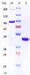 Anti-Monkeypox virus/MPXV A35R Nanobody (A145)