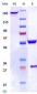 Anti-Monkeypox virus/MPXV A35R Mouse Antibody (A094)