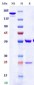 Anti-Monkeypox virus/MPXV A29L Antibody (A96)