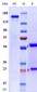 Anti-Monkeypox virus/MPXV A29L Mouse Antibody (B057)