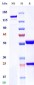 Anti-Monkeypox virus/MPXV A29L Mouse Antibody (B147)