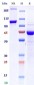 Monkeypox Virus (strain Zaire-96-I-16) B6R, Fc Tag