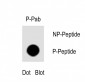 Phospho-PDPK1(S396) Antibody