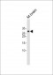 EMX1 Antibody (C-term)