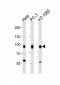 CD44 Antibody (C-term) [Knockout Validated]