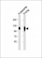 LAMP2 Antibody [Knockout Validated]