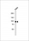 Stat3 Monoclonal Antibody [Knockout Validated]