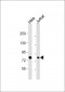 HADHA Antibody (C-term) [Knockout Validated]