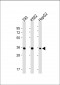 LIN28B Antibody [Knockout Validated]