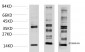 S100 A8+A9 (11C12) Mouse Monoclonal Antibody