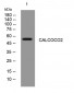 CALCOCO2 Rabbit Polyclonal Antibody