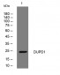 DUPD1 Rabbit Polyclonal Antibody