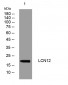 LCN12 Rabbit Polyclonal Antibody