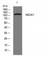 MICA1 Rabbit Polyclonal Antibody