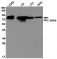 PKC alpha (16Q15) Rabbit Monoclonal Antibody