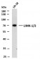 LIMK-1/2 (PTR2545) Mouse Monoclonal Antibody