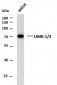 LIMK-1/2 (PTR2545) Mouse Monoclonal Antibody