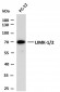 LIMK-1/2 (PTR2545) Mouse Monoclonal Antibody