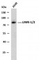 LIMK-1/2 (PTR2545) Mouse Monoclonal Antibody