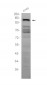 SMARCC2/BAF170 (11S2) Rabbit Monoclonal Antibody