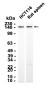 SMARCC2/BAF170 (11S2) Rabbit Monoclonal Antibody