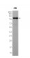 PI3-Kinase p85 beta (2C3) Rabbit Monoclonal Antibody