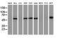 CALCOCO2 (14R16) Mouse Monoclonal antibody