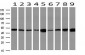 CALCOCO2 (14R16) Mouse Monoclonal antibody