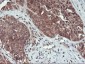 HDHD1 (18L10) Mouse Monoclonal antibody