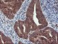 HDHD1 (5Z16) Mouse Monoclonal antibody