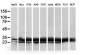 HDHD1A (13I13) Mouse Monoclonal antibody