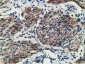 MICAL1 (14Q4) Mouse Monoclonal antibody